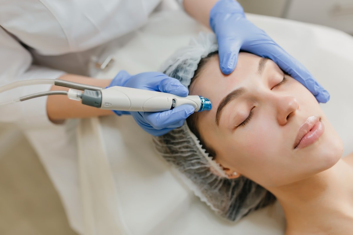 Chemical Peel