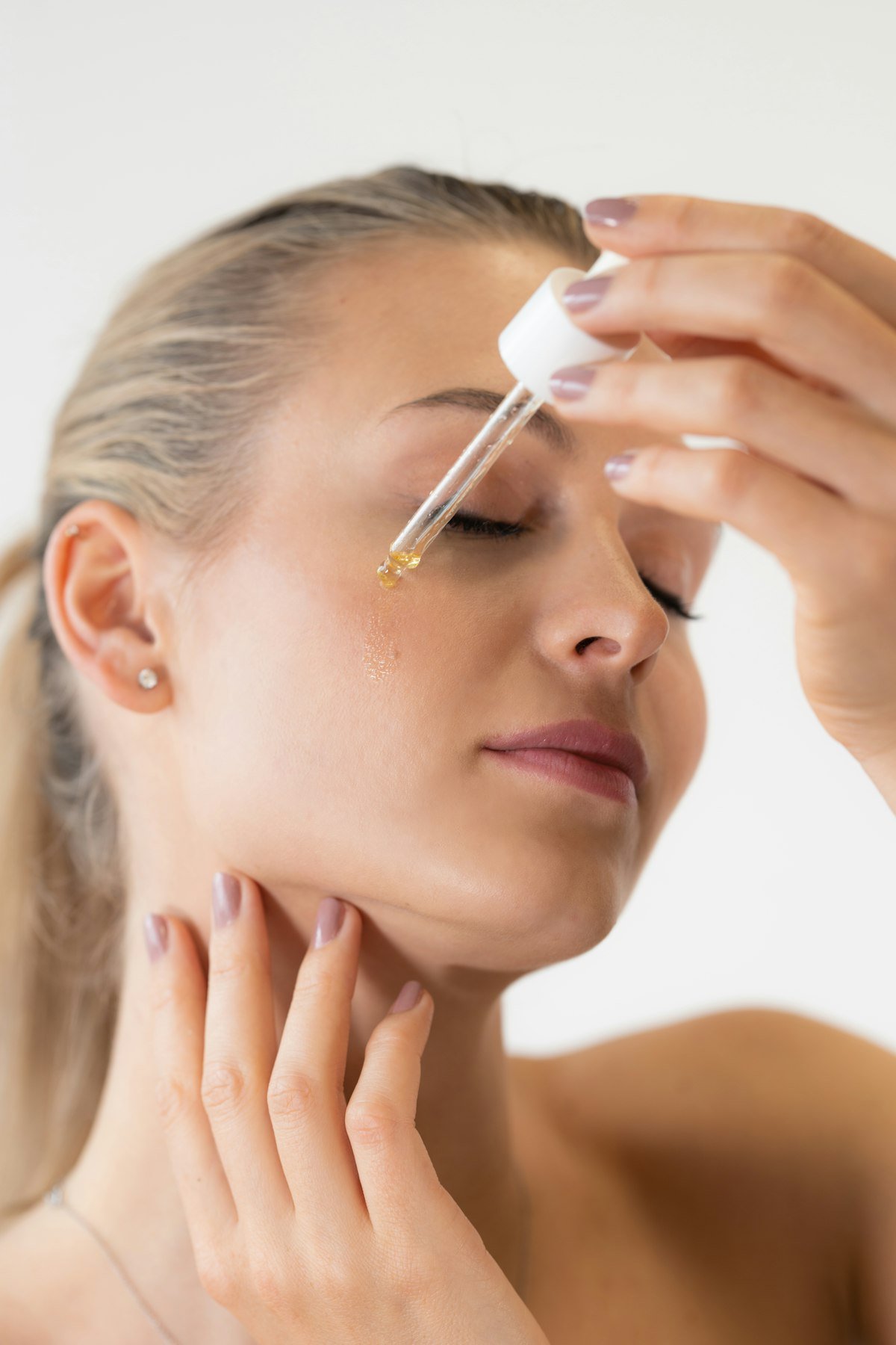Acne Treatment